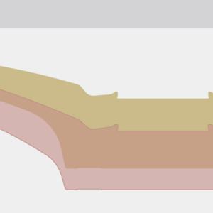 Concave comparison diagram