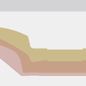 Concave comparison diagram